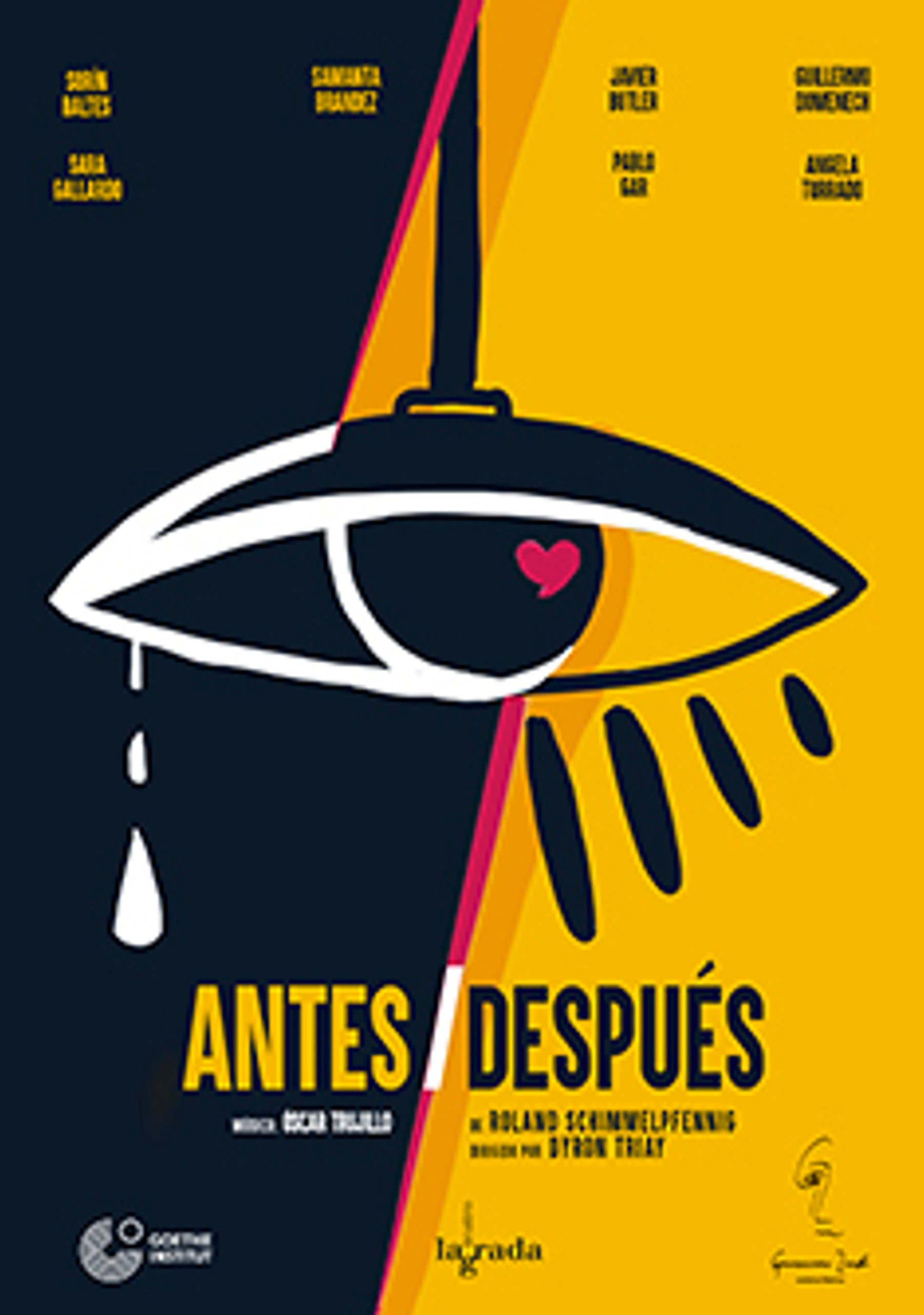 Antes/Después